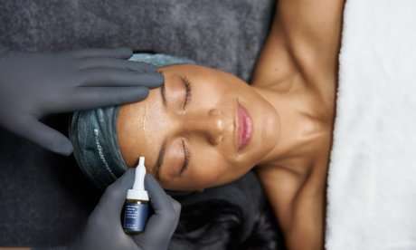 Microneedling treatment with dermalogica exosomes