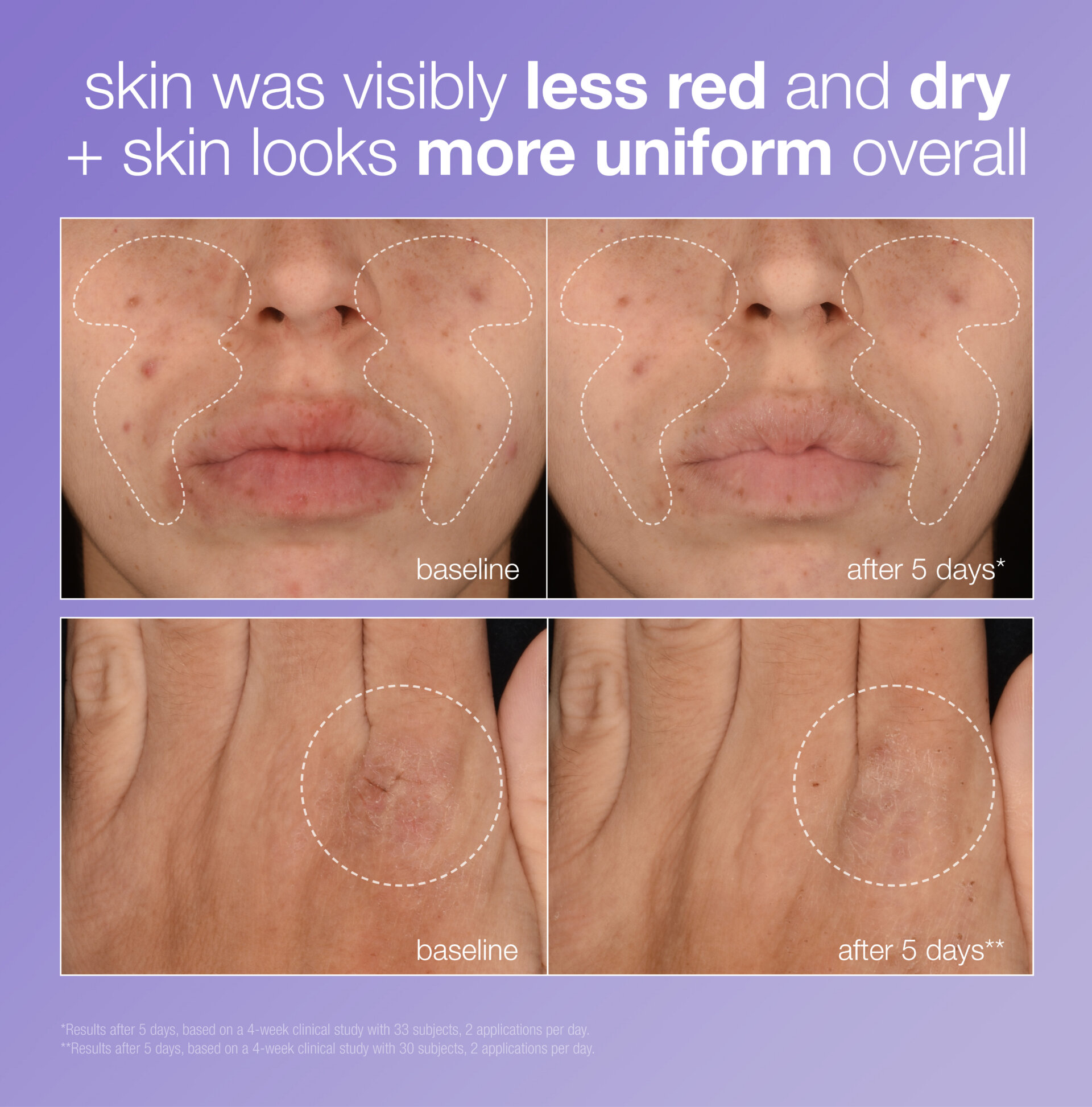 clinical results of stabilizing repair serum before and after